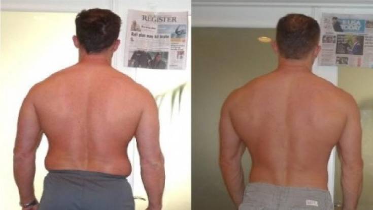 Dont Hide Your Arms Anymore: An Arm Fat Blaster to Bra-Back-Fat-010